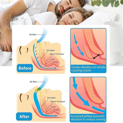 Anti Snore Stop Snoring Nose Clip Silicone Magnetic Sleep Tray