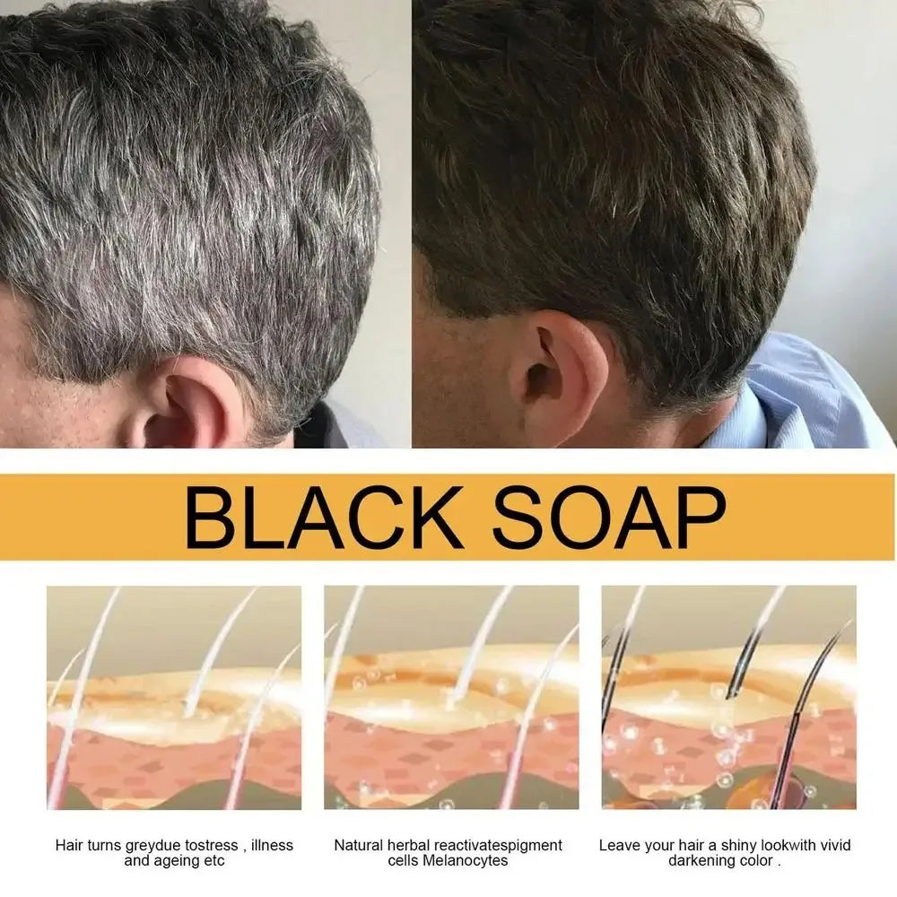 Hair Shampoo Soap Polygonum Multiflorum Black Soap White Hair Repair