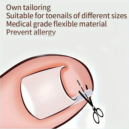 Ingrown Toenail Correction Tool Ingrown Toe Nail Treatment Elastic