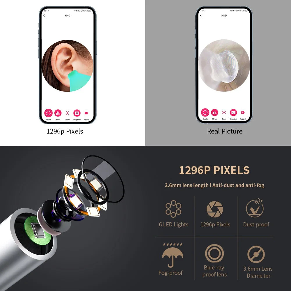 Smart Visual Ear Cleaner with Camera 1296P Ear Sticks USB C Charging