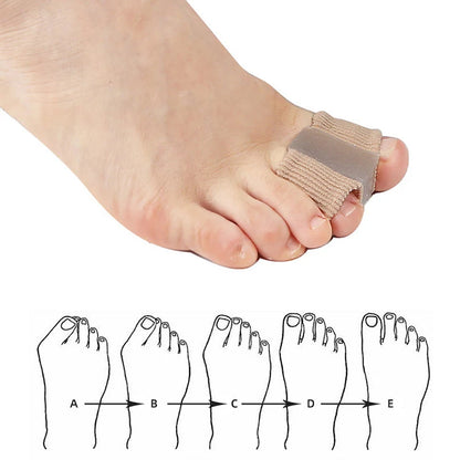1Pcs Silicone Toe Spreader Separator Bunion Hallux Valgus Corrector
