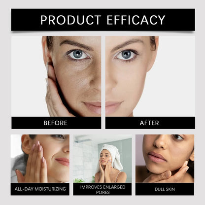 Korean Eye Cream For Anti-wrinkle & Age Retinol Eye Cream Remove Dark