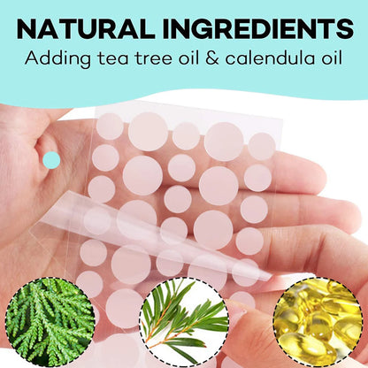 180/360/720 patches/box of hydrogel acne patches can effectively cover
