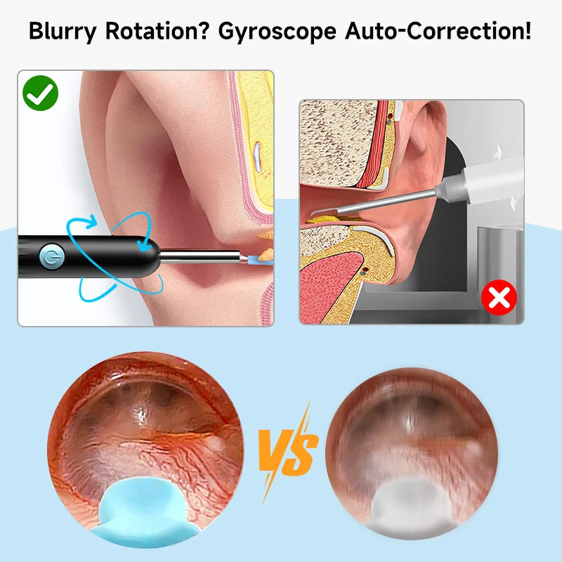 WiFi Visual Ear scope Camera 1080P for iPhone/Android Ear Picker