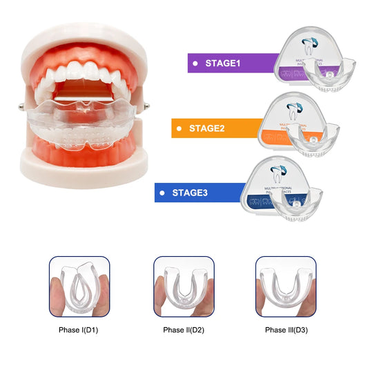 Dental Accessories 3 Stages Dental Braces Teeth Trainer Alignment