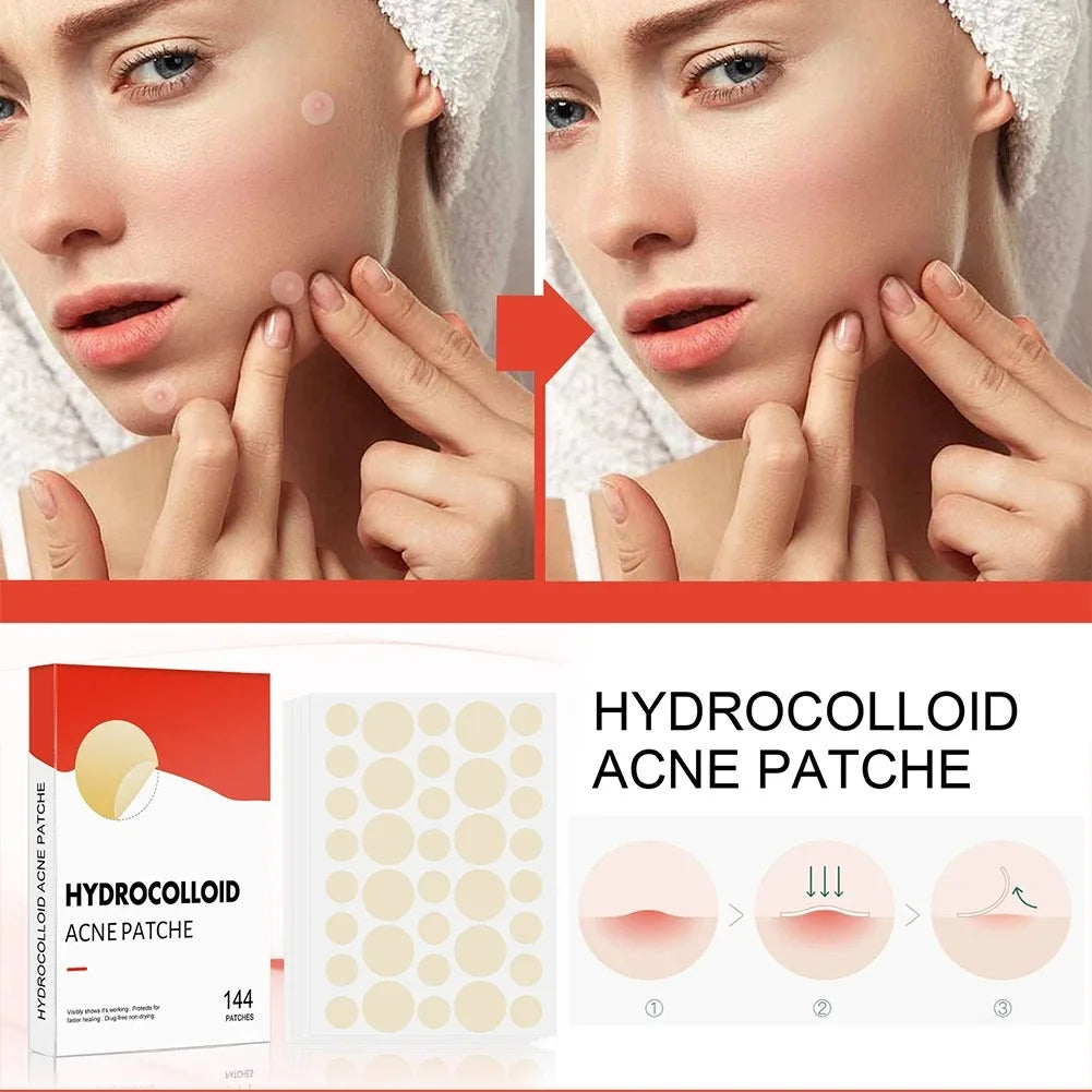 144pcs Face Acne Patch Invisible Skin Care Pimple Acne Patches