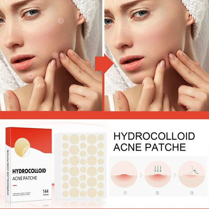 144pcs Face Acne Patch Invisible Skin Care Pimple Acne Patches