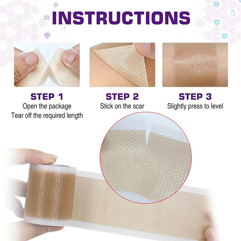 Waterproof & Reusable Silicone Scar Tape – Breathable, Skin-Friendly