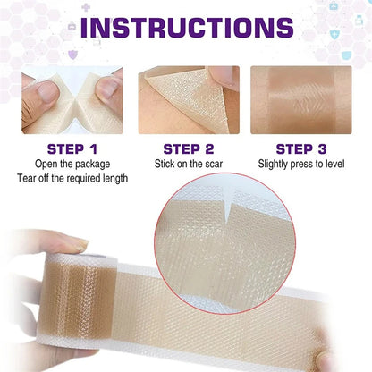 Waterproof & Reusable Silicone Scar Tape – Breathable, Skin-Friendly