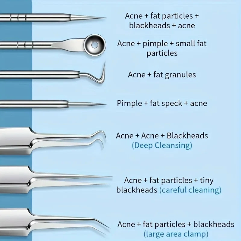 8-Piece Blackhead Remover Kit – Stainless Steel Blemish & Acne