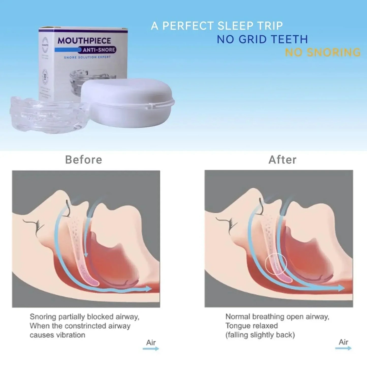 Adjustable Anti-Snoring Mouth Guard  Mouthpiece Sleeping Devices