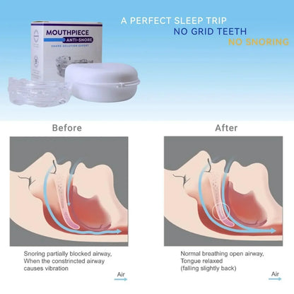 Adjustable Anti-Snoring Mouth Guard  Mouthpiece Sleeping Devices
