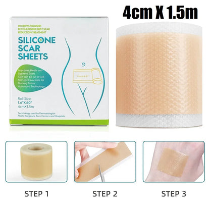 4cm X 150cm Silicone Scar Sheets , 1 Roll Self-Adhesive Scar Cover