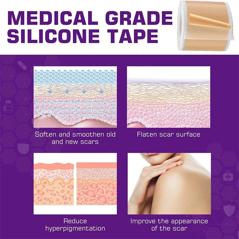 Waterproof & Reusable Silicone Scar Tape – Breathable, Skin-Friendly