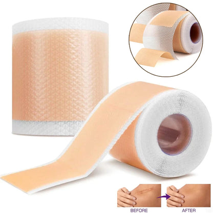 Waterproof & Reusable Silicone Scar Tape – Breathable, Skin-Friendly