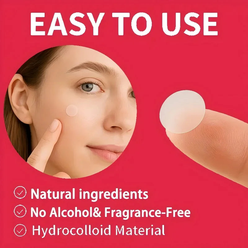 1200 pieces/set of hydrogel patches for acne coverage, suitable for