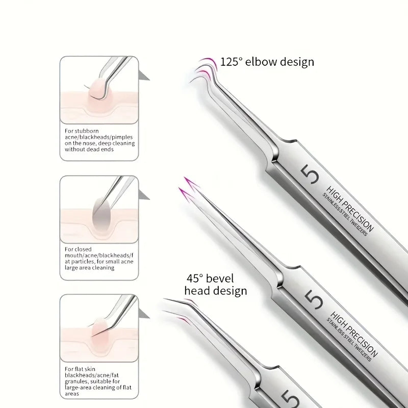 8-Piece Blackhead Remover Kit – Stainless Steel Blemish & Acne