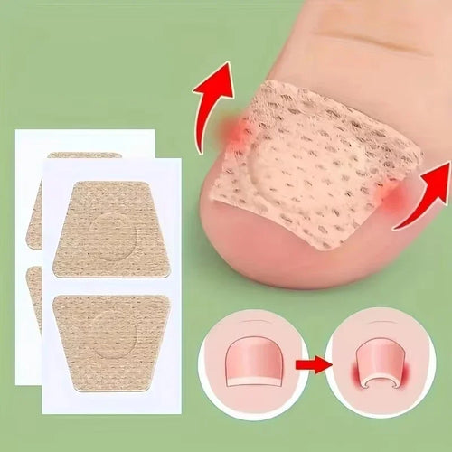 Nail Repair Patch Grey Fungal Nails Thickening Soft Paronychia