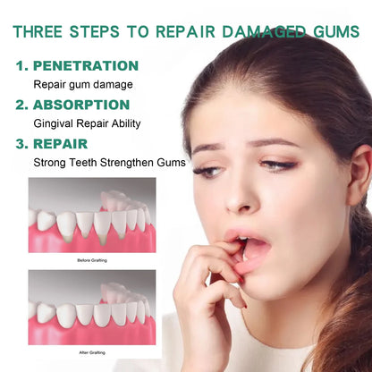 Gum Repair Drops Relieve Receding Gingival Swelling Gum Cleaning Care