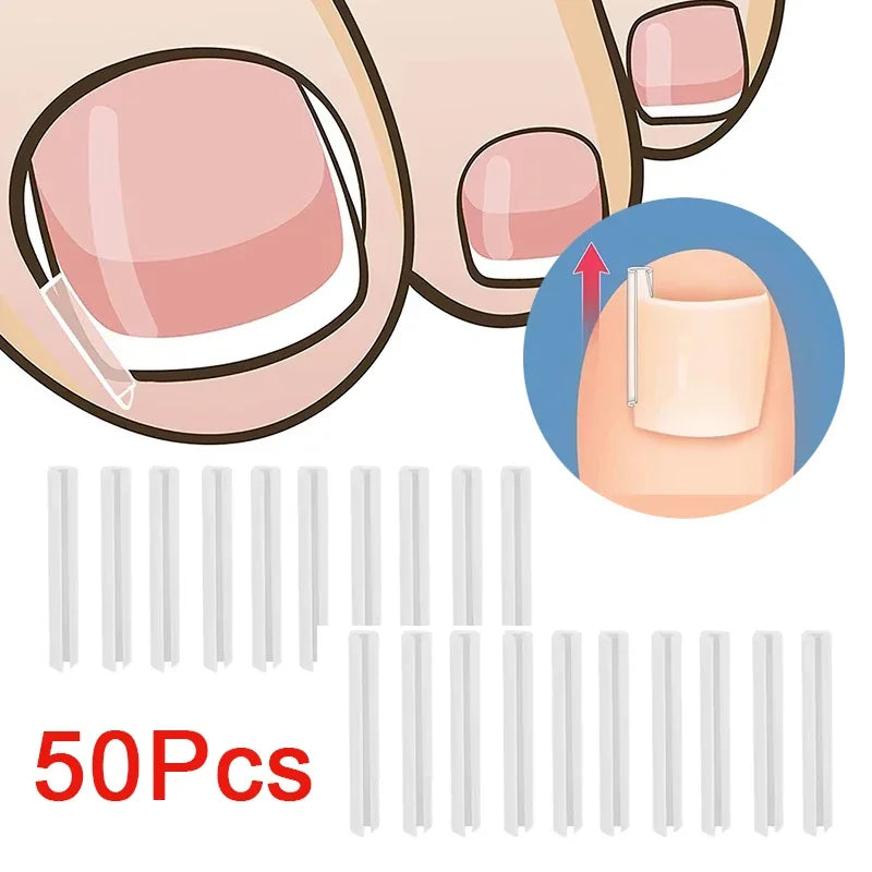 50Pcs Elastic Patch Sticker Pedicure Tool Ingrown Toenail Correction