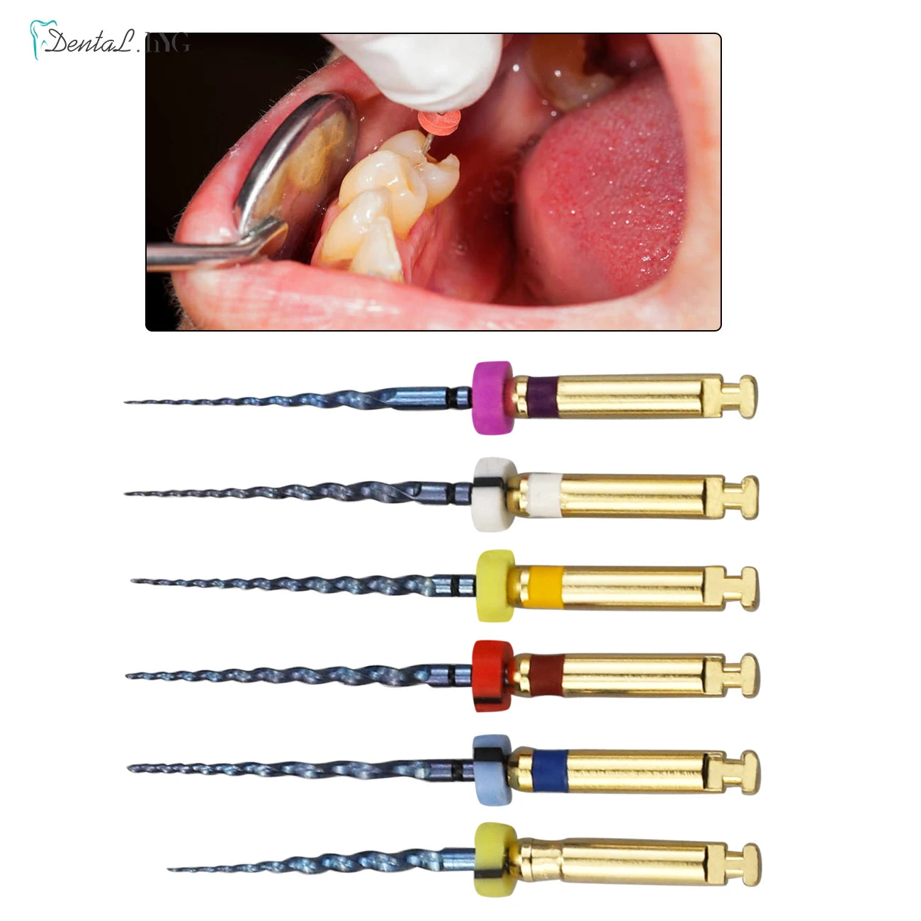 Dental Root Canal File Gold Endo Rotary Super Files Golden Endodontic