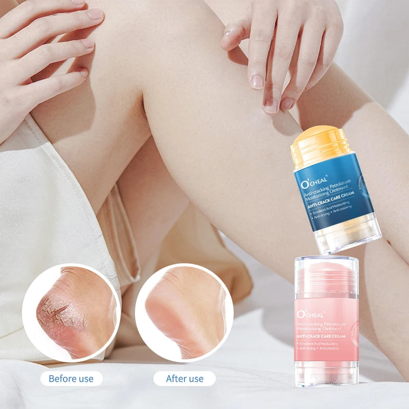 Anti Crack Foot Cream For Dry And Cracked Feet And Heels, Moisturizing